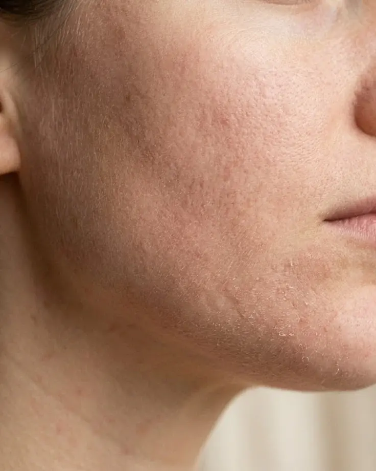 Dull Skin